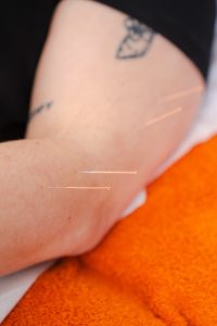 Pain Treatment Bideford