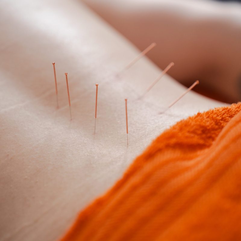 dry needles